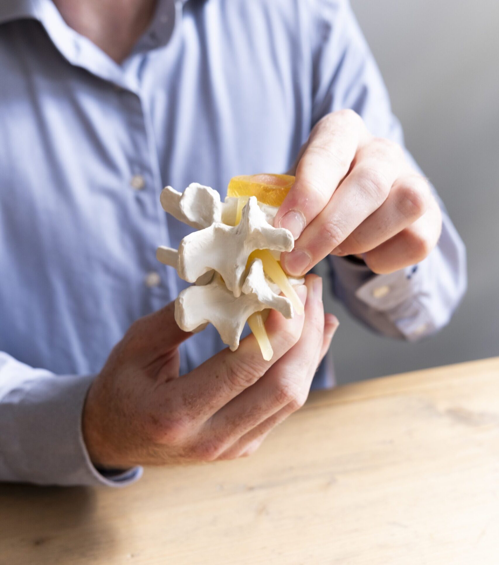 Subluxatie van de wervelkolom